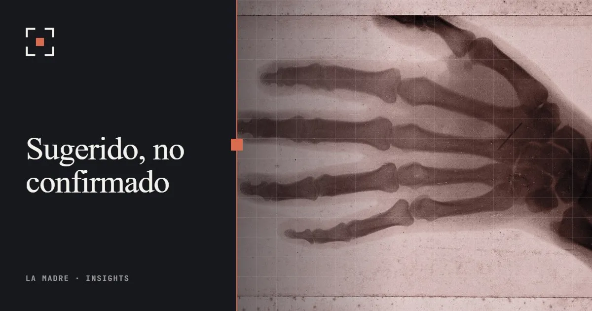 Una antigua impresión de rayos X de los huesos de una mano, en duotono La Madre, junto a las palabras Sugerido, no confirmado